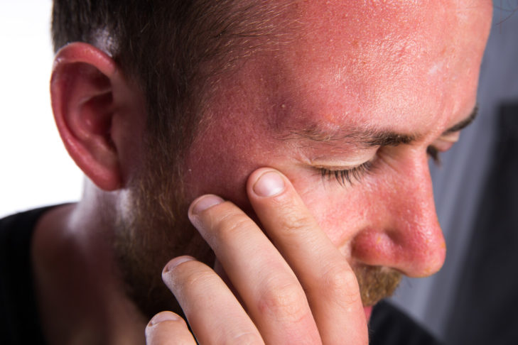 Pijnlijk en schadelijk voor de gezondheid: zonnebrand.